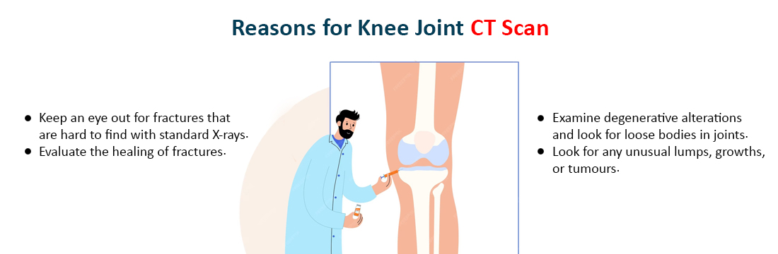 Reasons for Knee Joint CT Scan